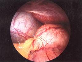 ftp://ftp.modmedworld.com/web/lap%20liver%20stomach%20duodenum.jpg