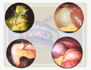ftp://ftp.modmedworld.com/web/Laparoscopy.jpg