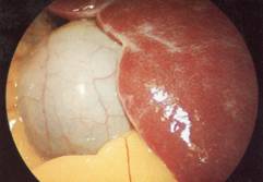 ftp://ftp.modmedworld.com/web/lap%20gallbladder.jpg